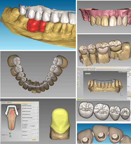 Cad Cam dentistico