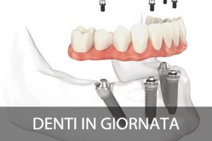 400-denti-in-giornata