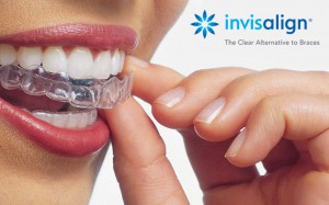 Invisalign